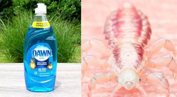 Does Dawn Dish Soap Kill Lice? The Surprising Answer! 2 How to use dawn dish soap to kill lice?
